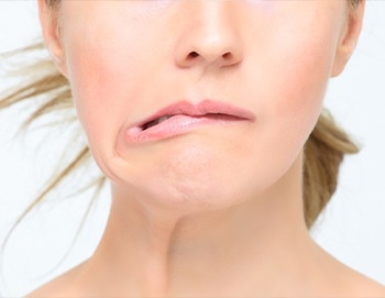 علاج تقلص العصب السابع
